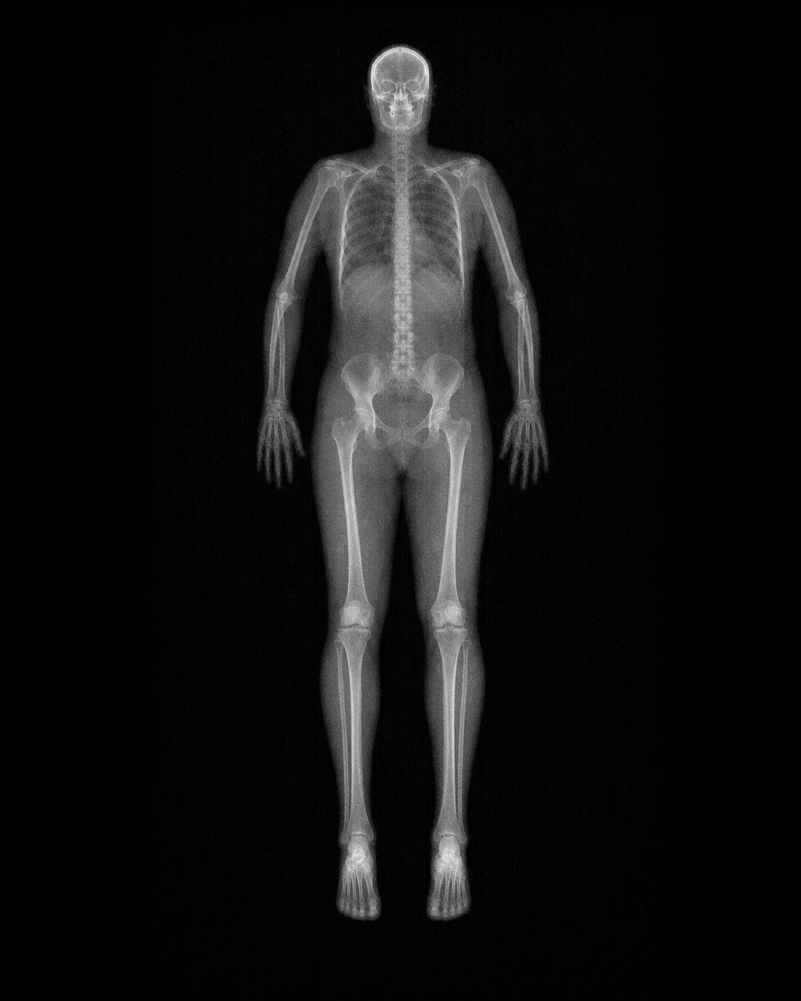 Illustrative whole-body DEXA-style acquisition with no patient data
